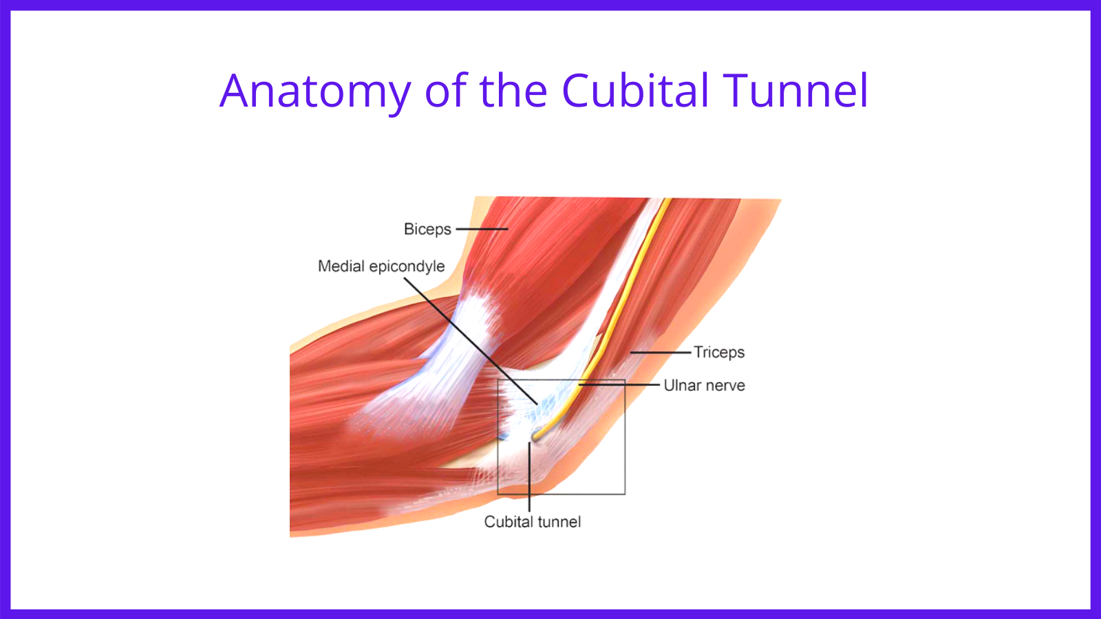 Cubital Tunnel Syndrome 4663