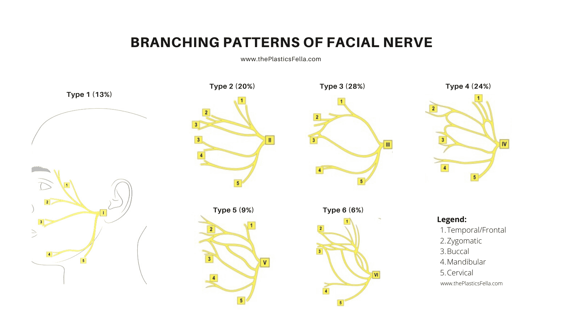 Temporal/Frontal Branch of Facial Nerve