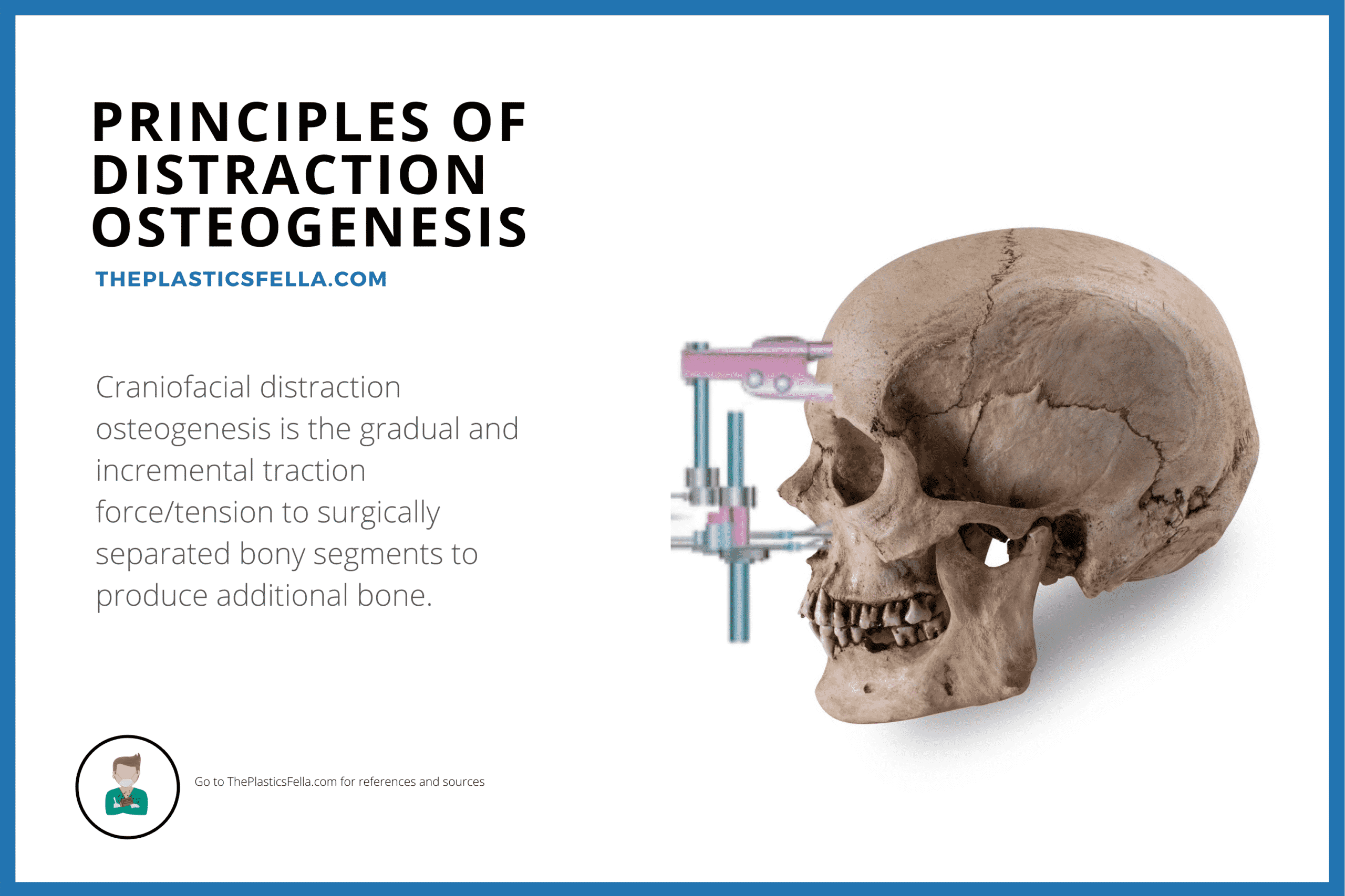 Principles of Craniofacial Distraction Osteogenesis