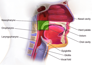 Velopharyngeal Insufficiency