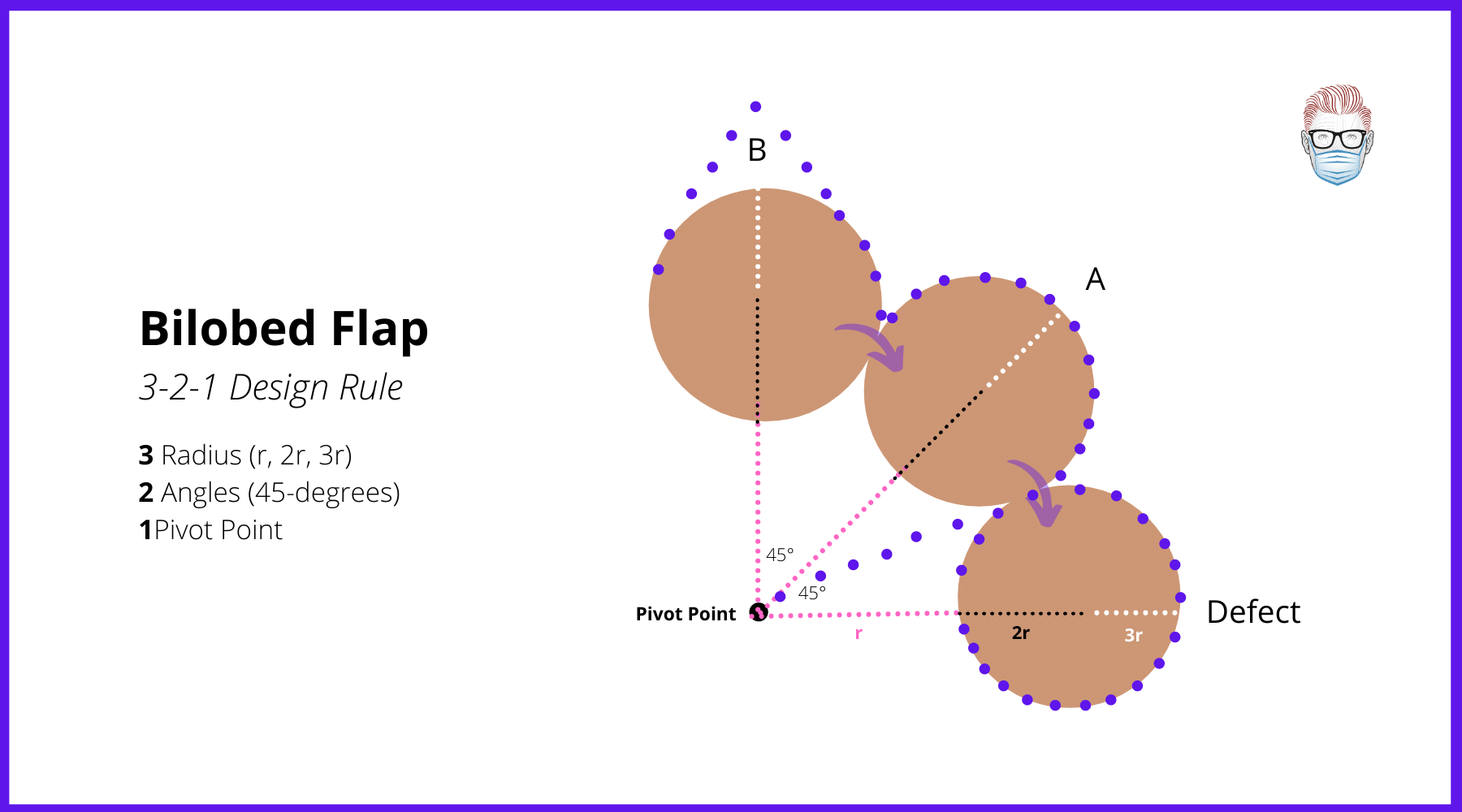 bilobed-flaps-indications-design-pictures