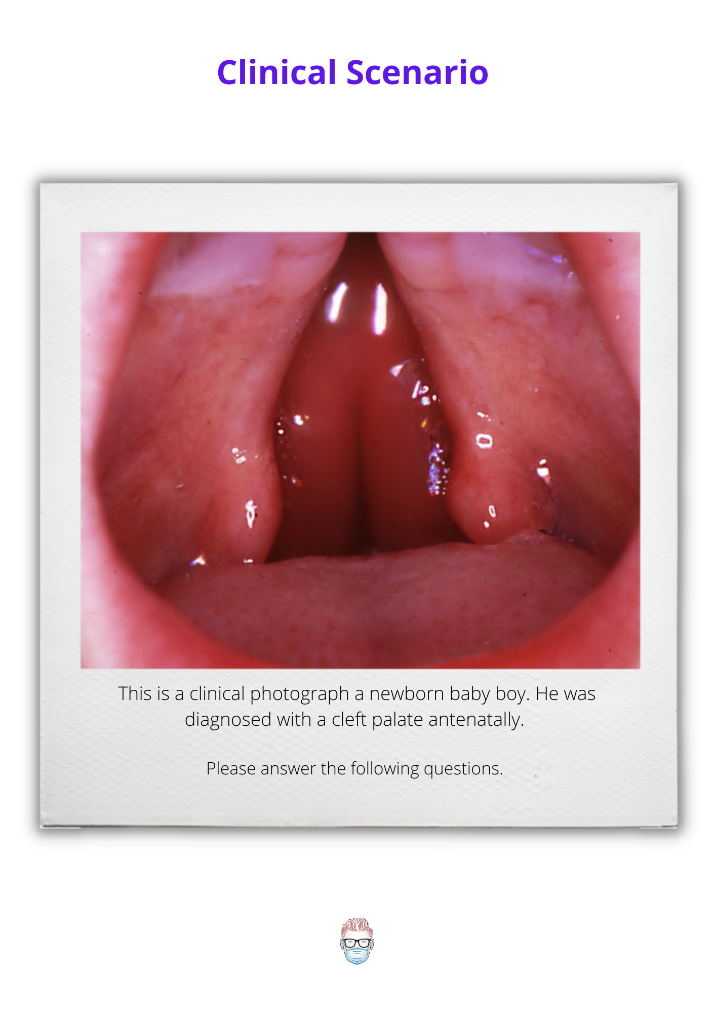 Cleft Palate Clinical Case