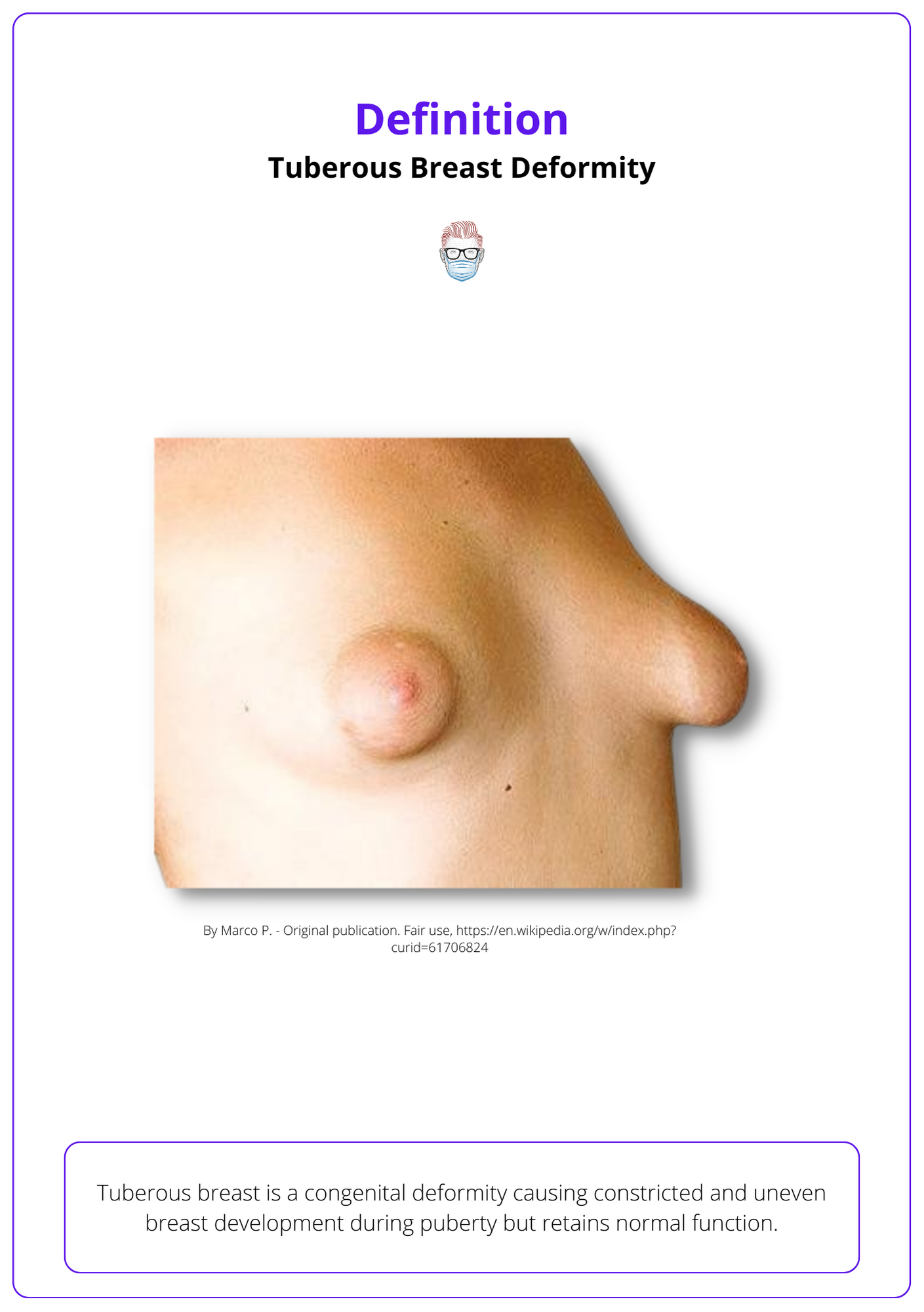 What are Tubular Breasts? Correction & Surgery