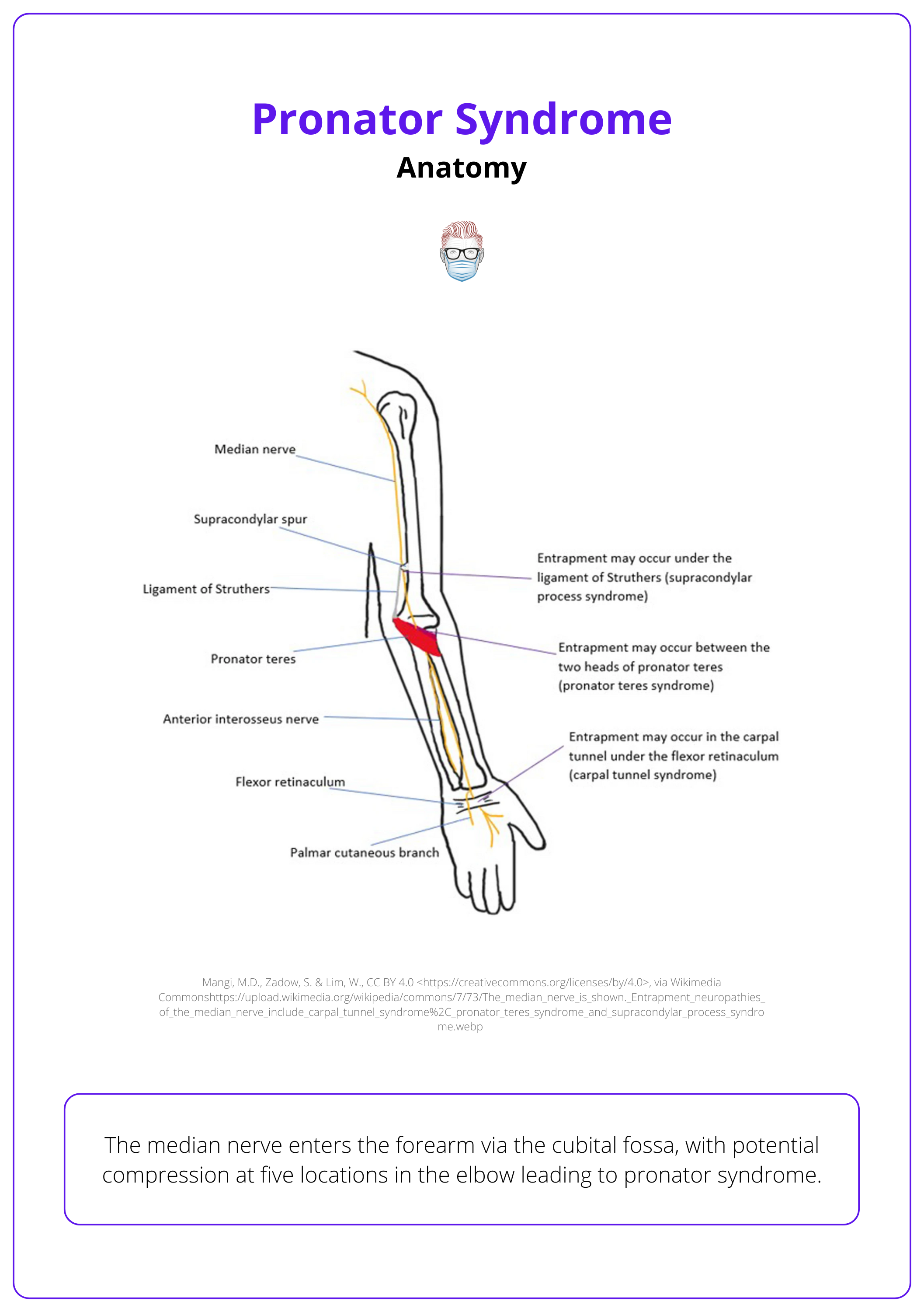 Median nerve neuropathy, compression neuropathy, pronator syndrome, carpal tunnel syndrome