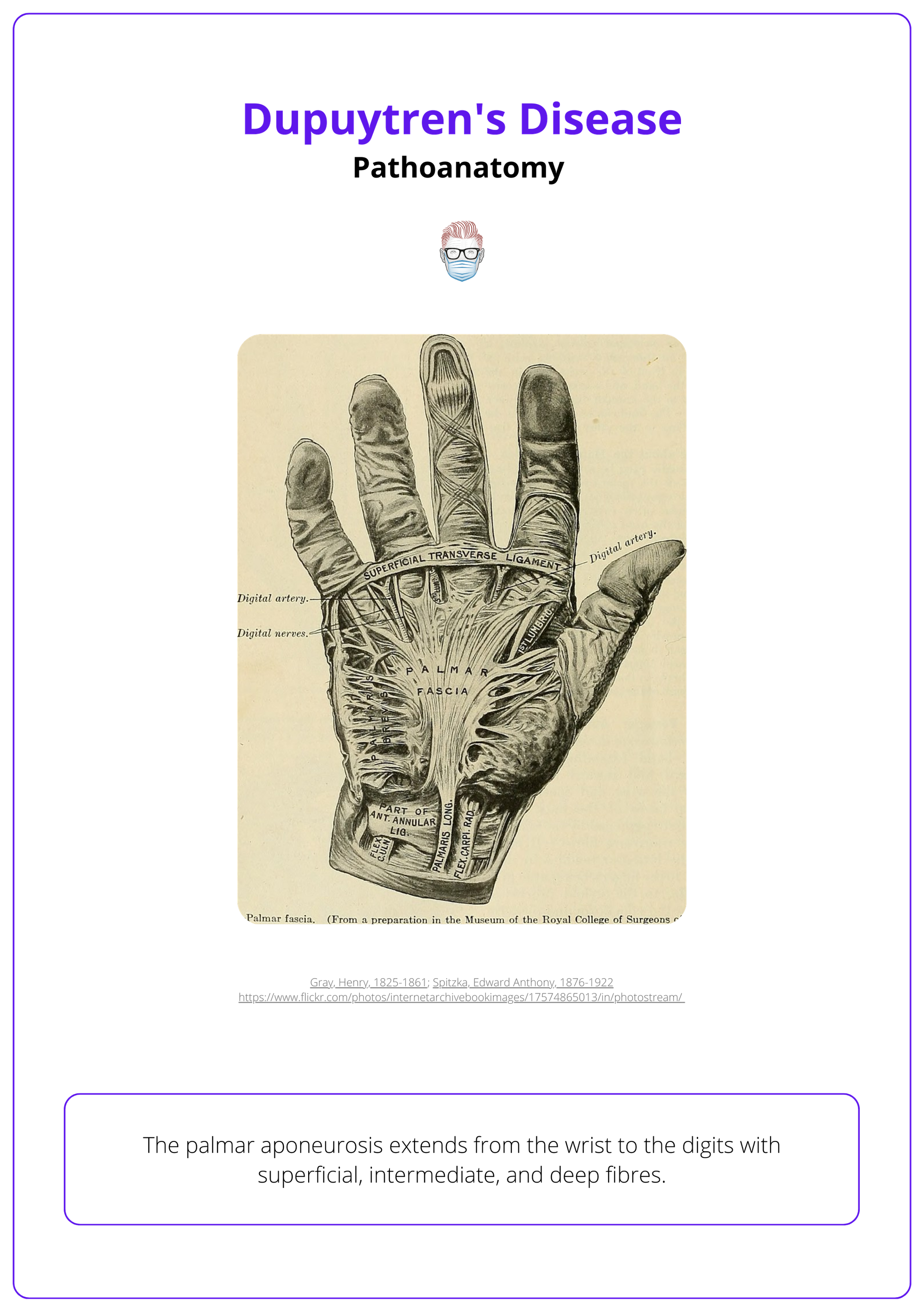 Cleland’s and Grayson's ligaments of the hand, Diagnosing Dupuytren's Disease