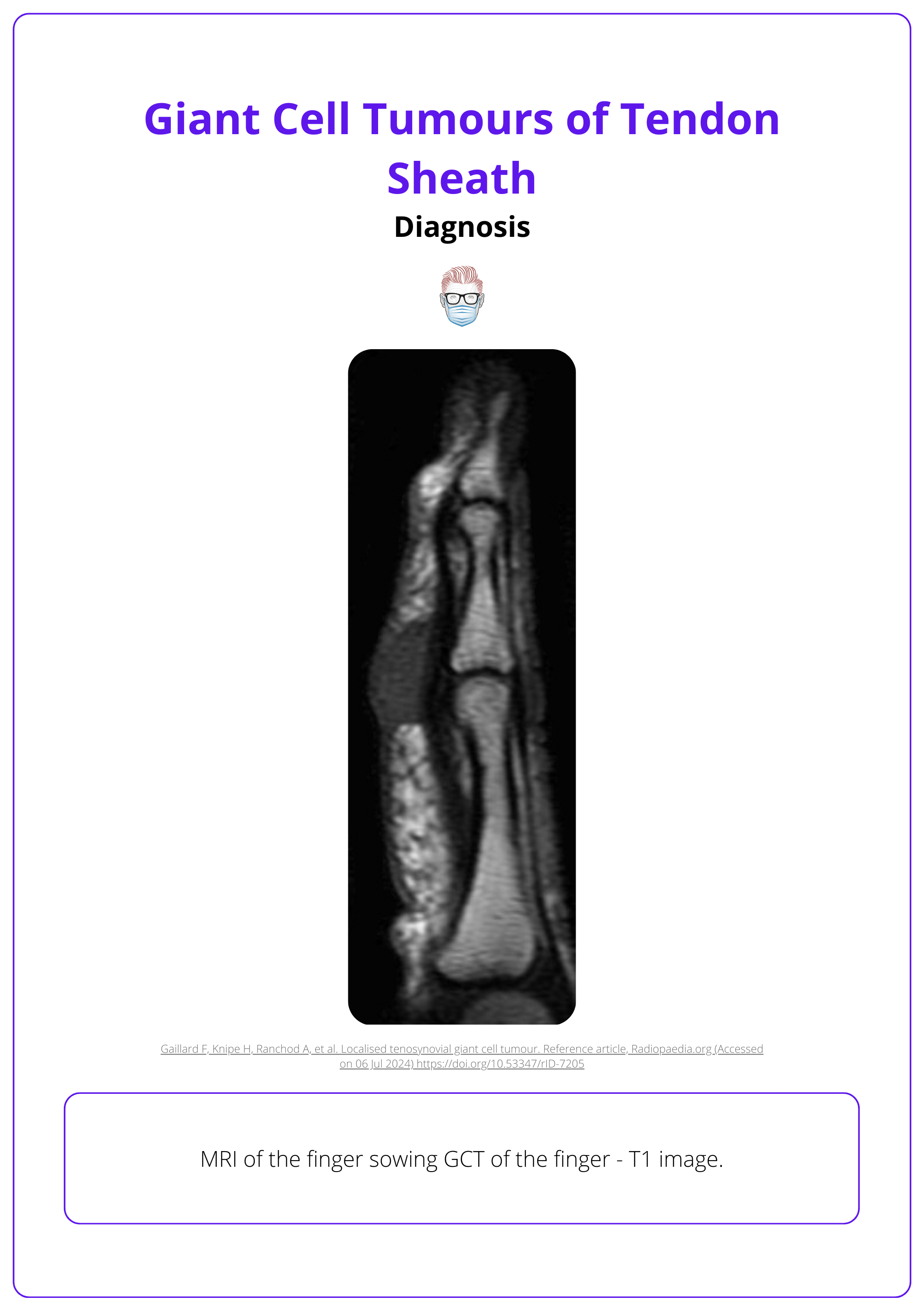 MRI of the finger sowing GCT of the finger. T1 image 