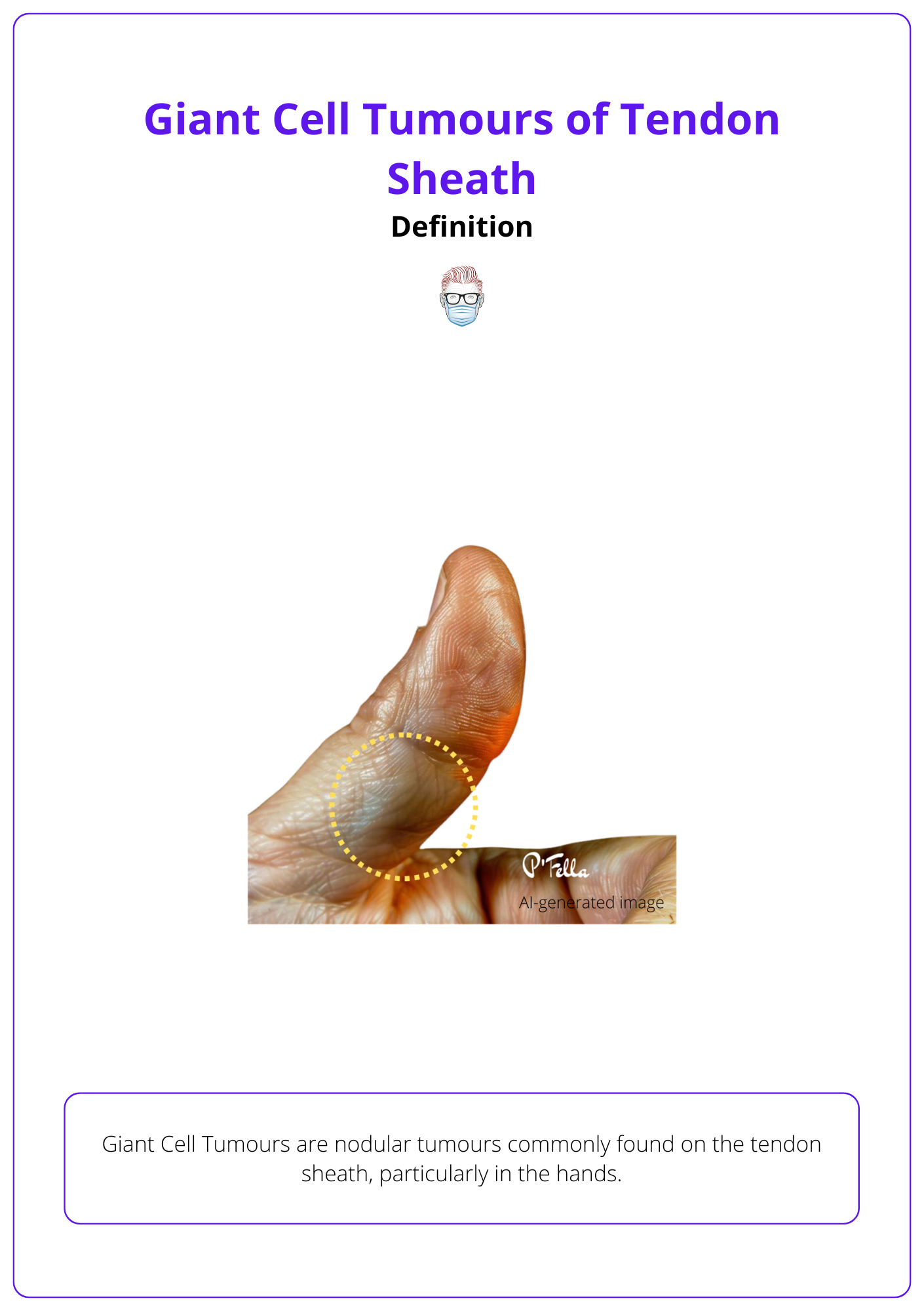 Definition of a giant cell tumour of the tendon sheath