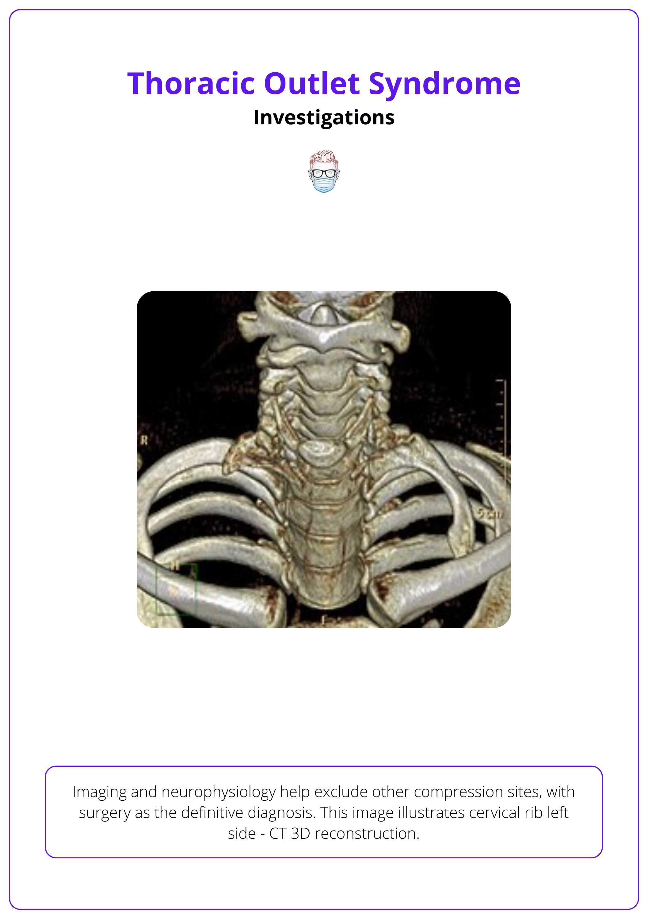 Cervical rib left side - CT 3D reconstruction for TOC, Thoracic Outlet Syndrome