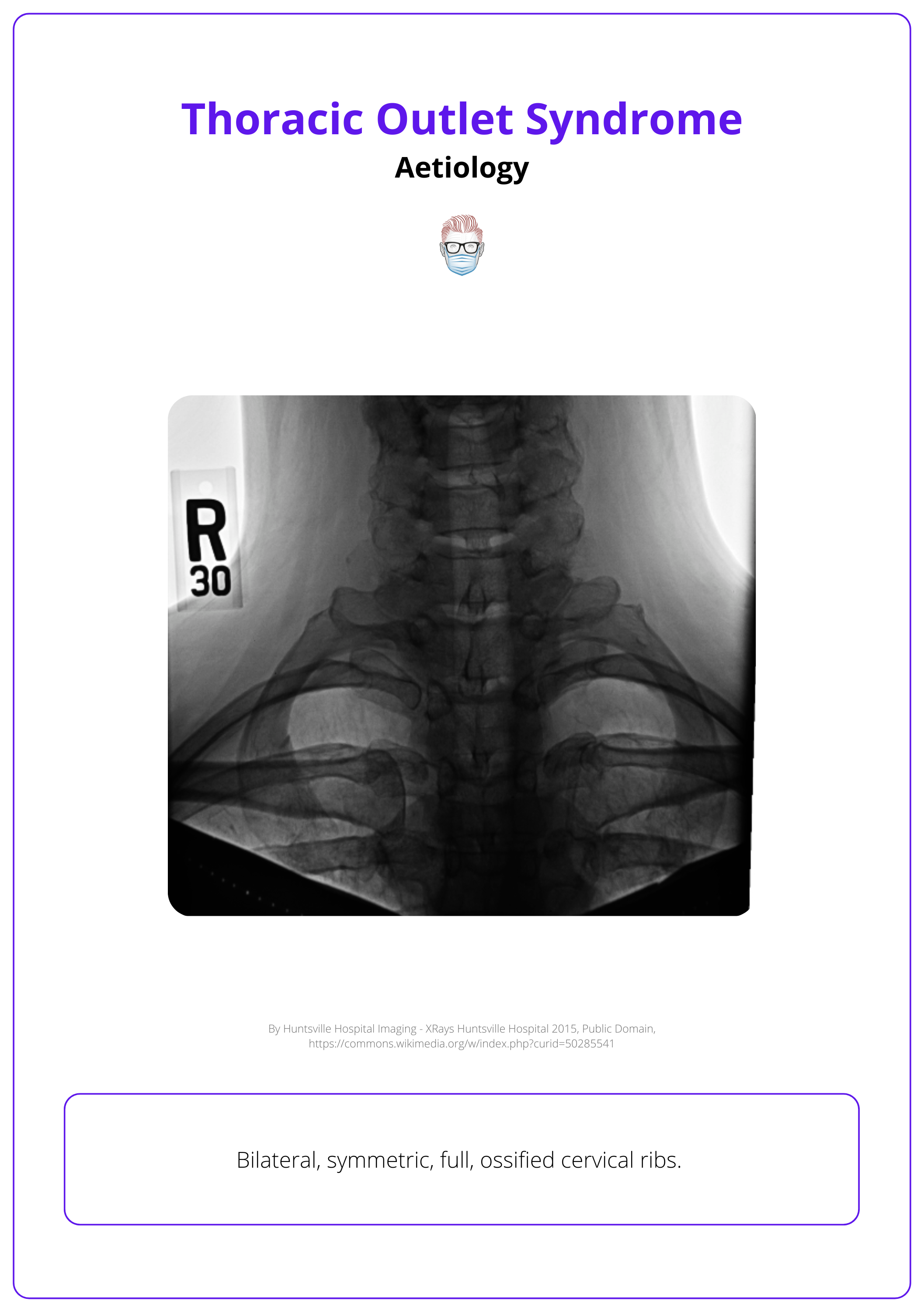 Imaging of the relevant anatomy of cervical ribs.