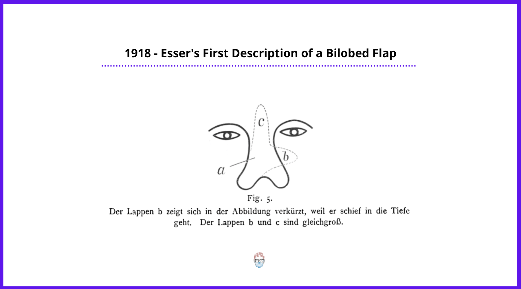 Esser's Original Publication of Bilobed Flaps