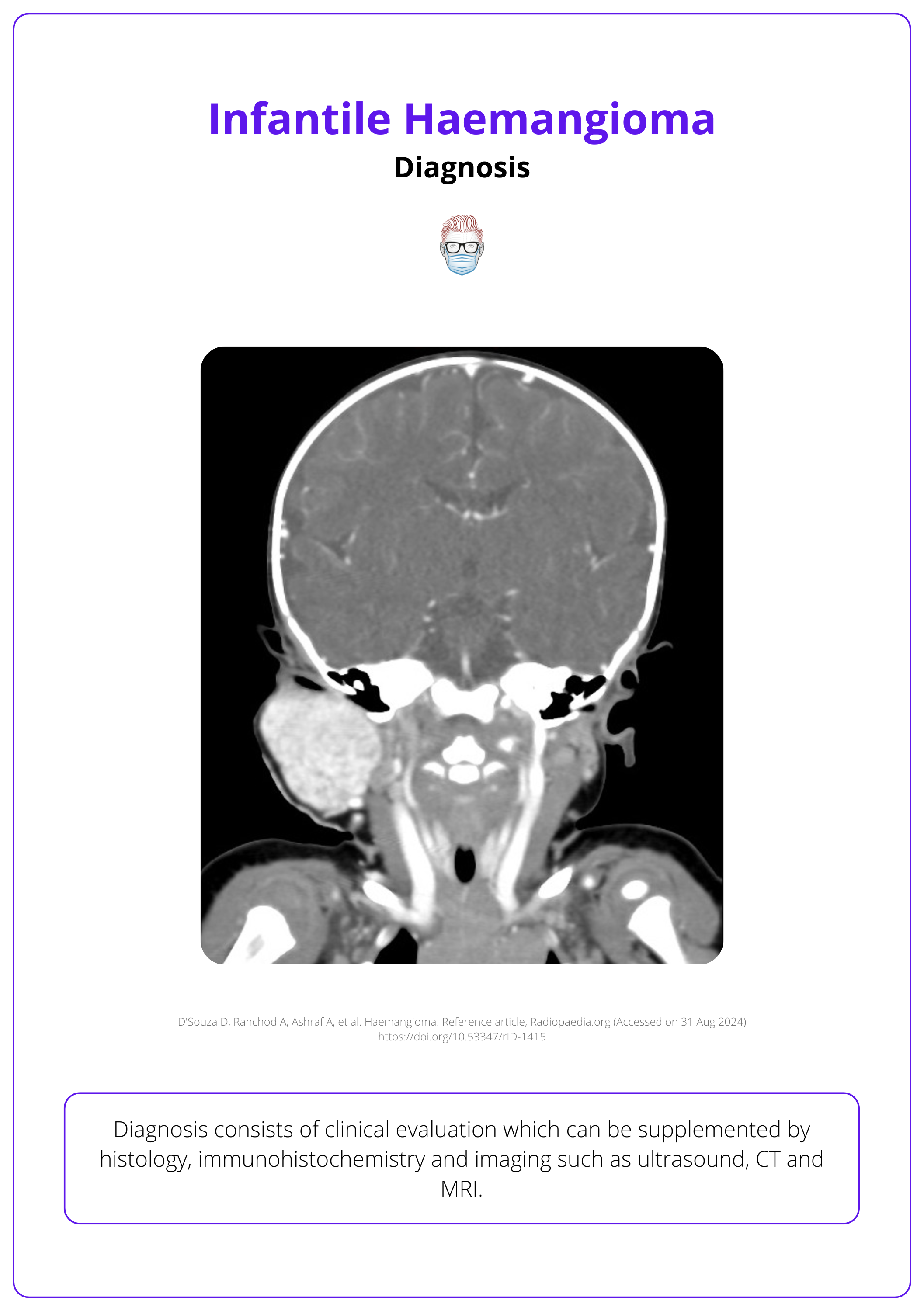 CT of a haemangioma, Coronal C+  arterial phase of a haemangioma