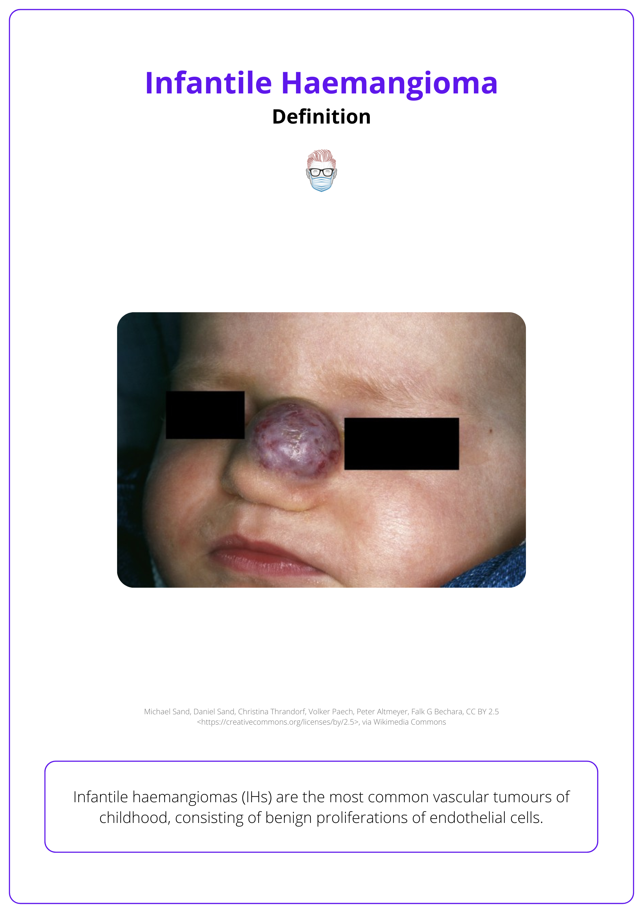 Infantile haemangioma on the nose of a one-year-old child.