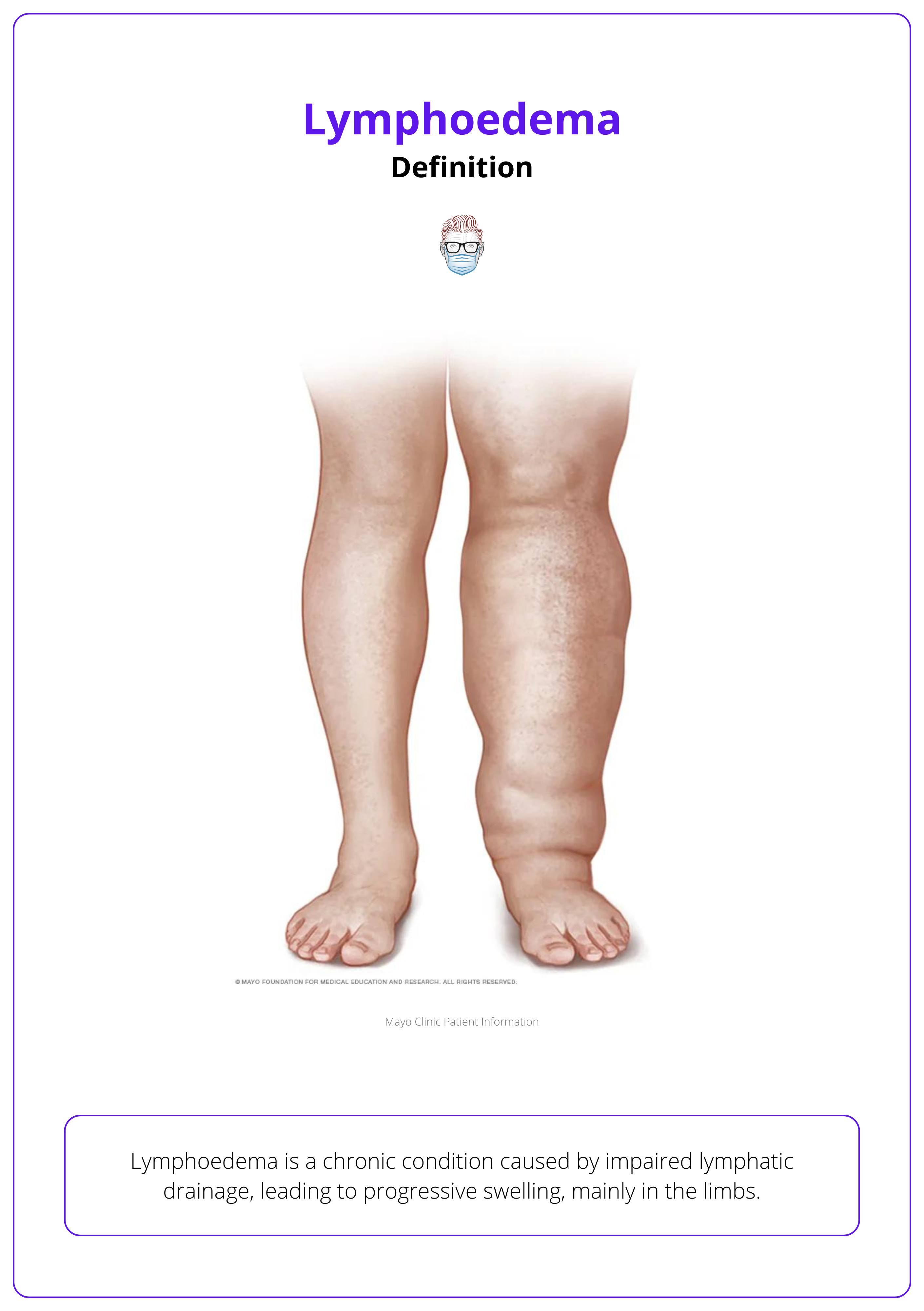 Lymphoedema, elephantiasis, lower limb swelling