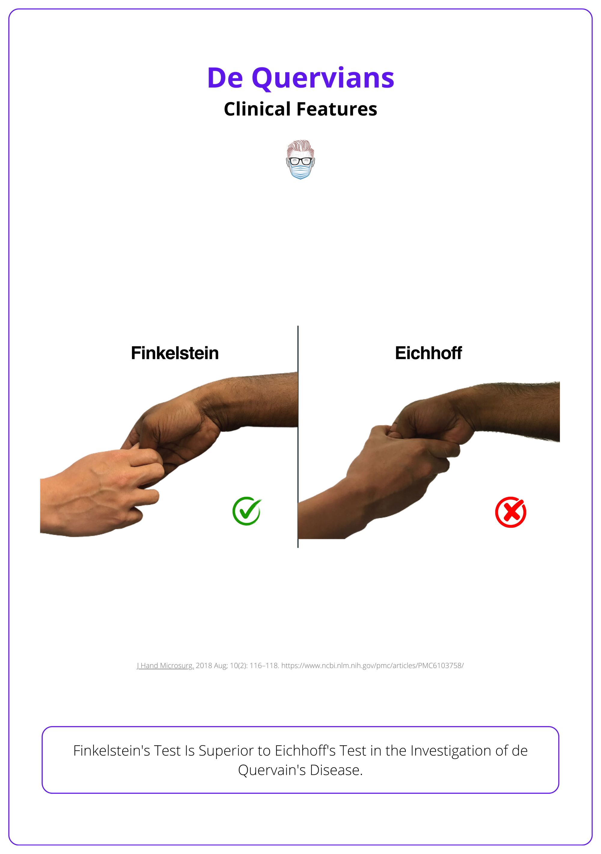 Comparison of Finkelstein Test and Eichoff Test: Highly sensitive for de Quervain’s tenosynovitis, aiming to reproduce sharp pain along the radial wrist.