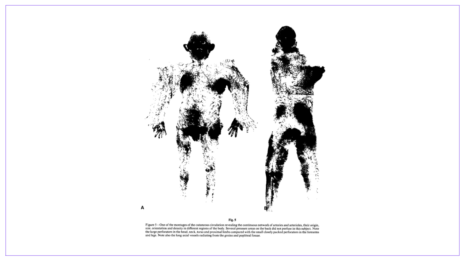 Original Taylor Publication in British Journal of Surgery: Angiosomes