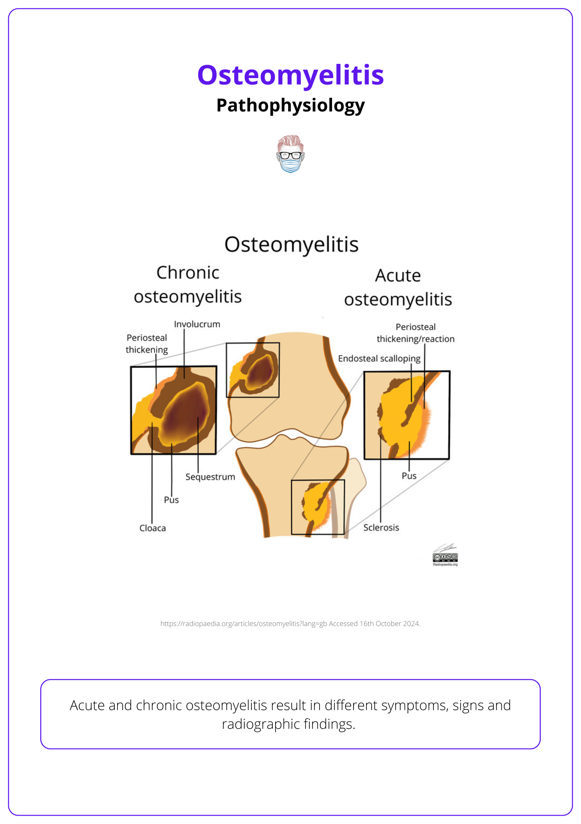 Acute and chronic osteomyelitis result in different symptoms, signs and radiographic findings. 