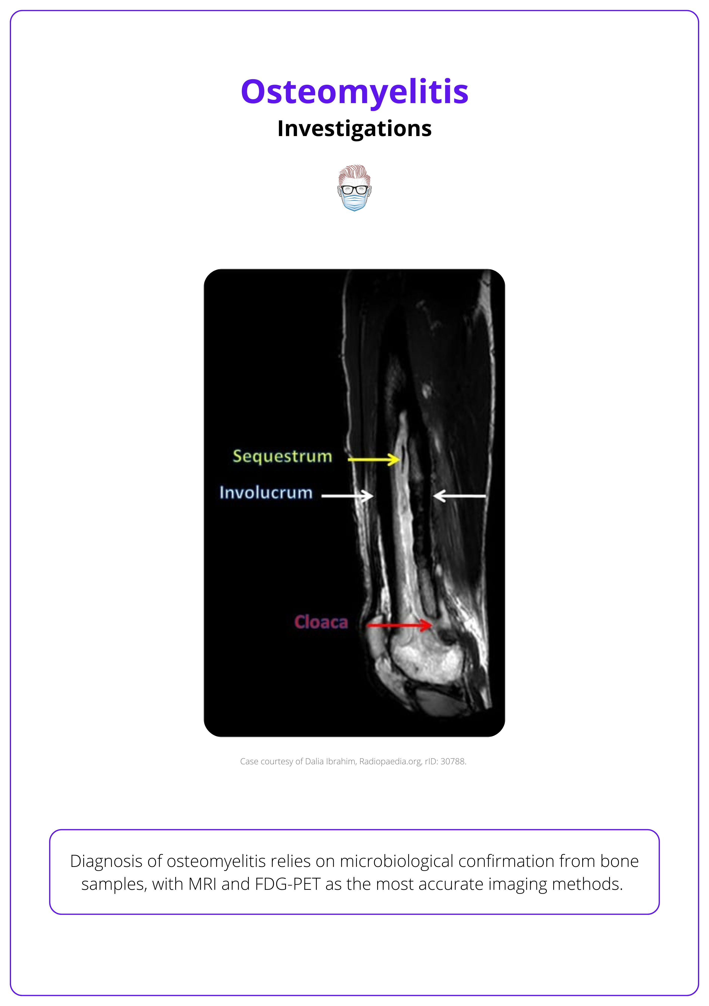 Radiological findings of osteomyelitis