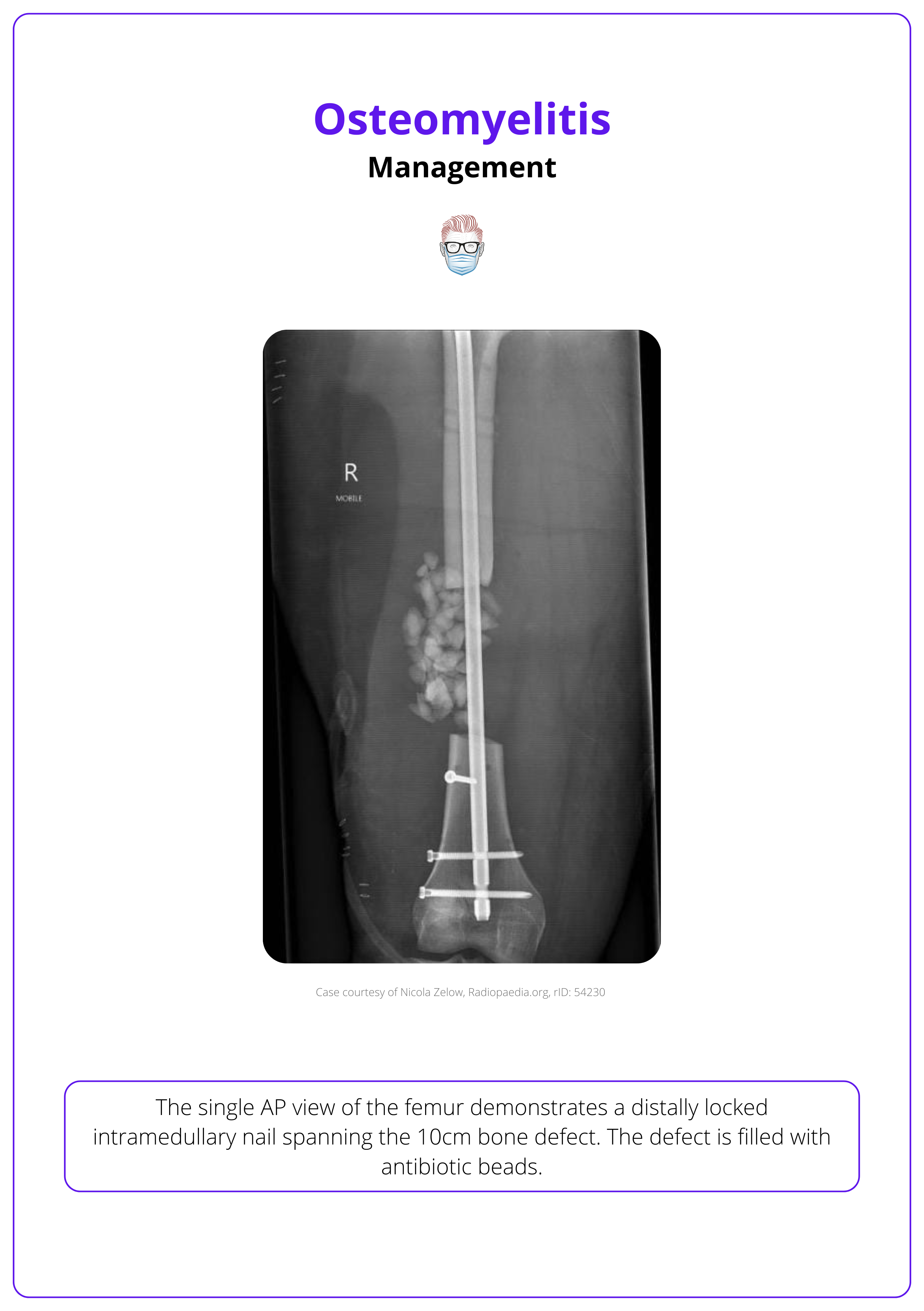 The single AP view of the femur, Osteomyelitis Management