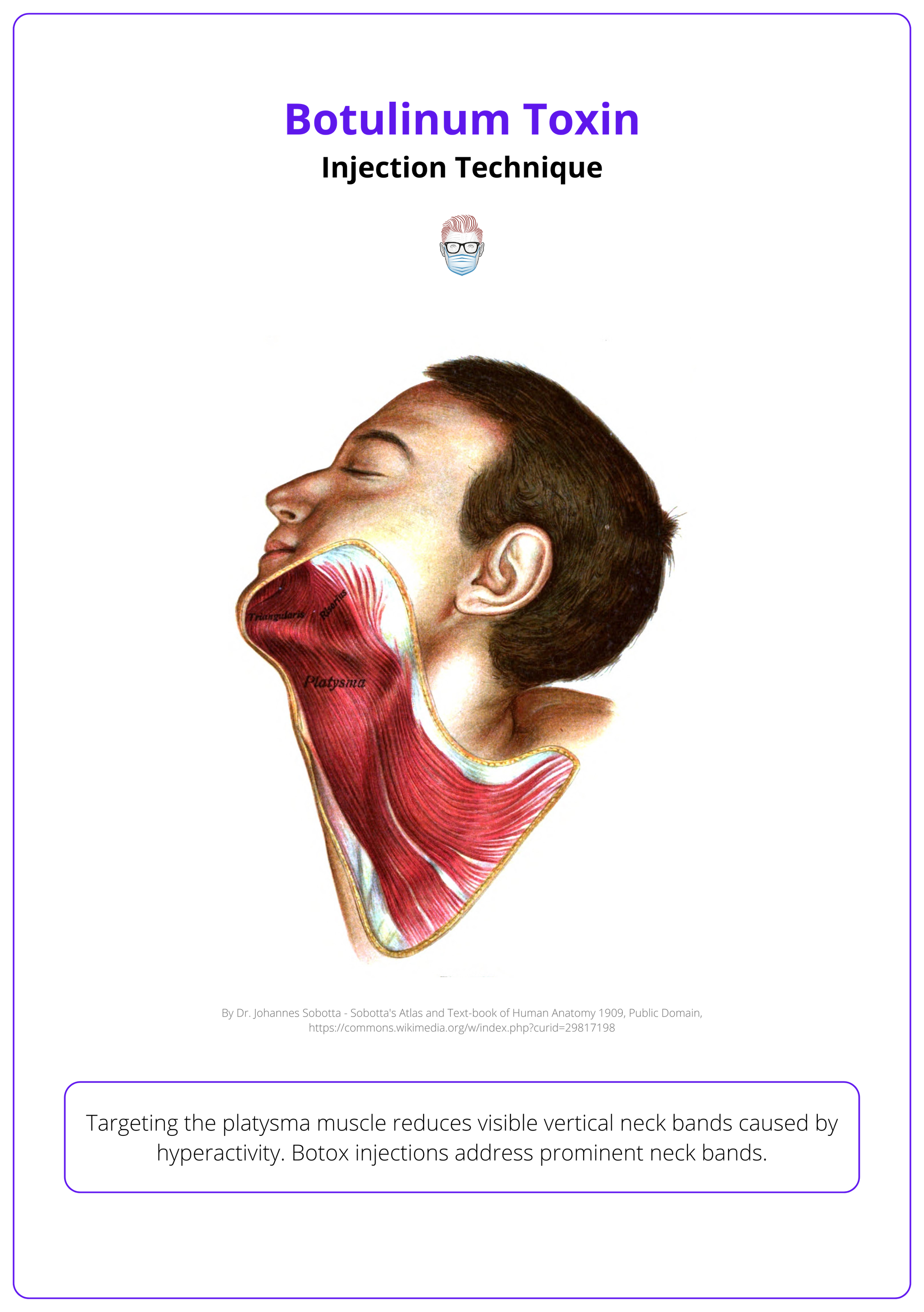 The anatomy of platysmal bands