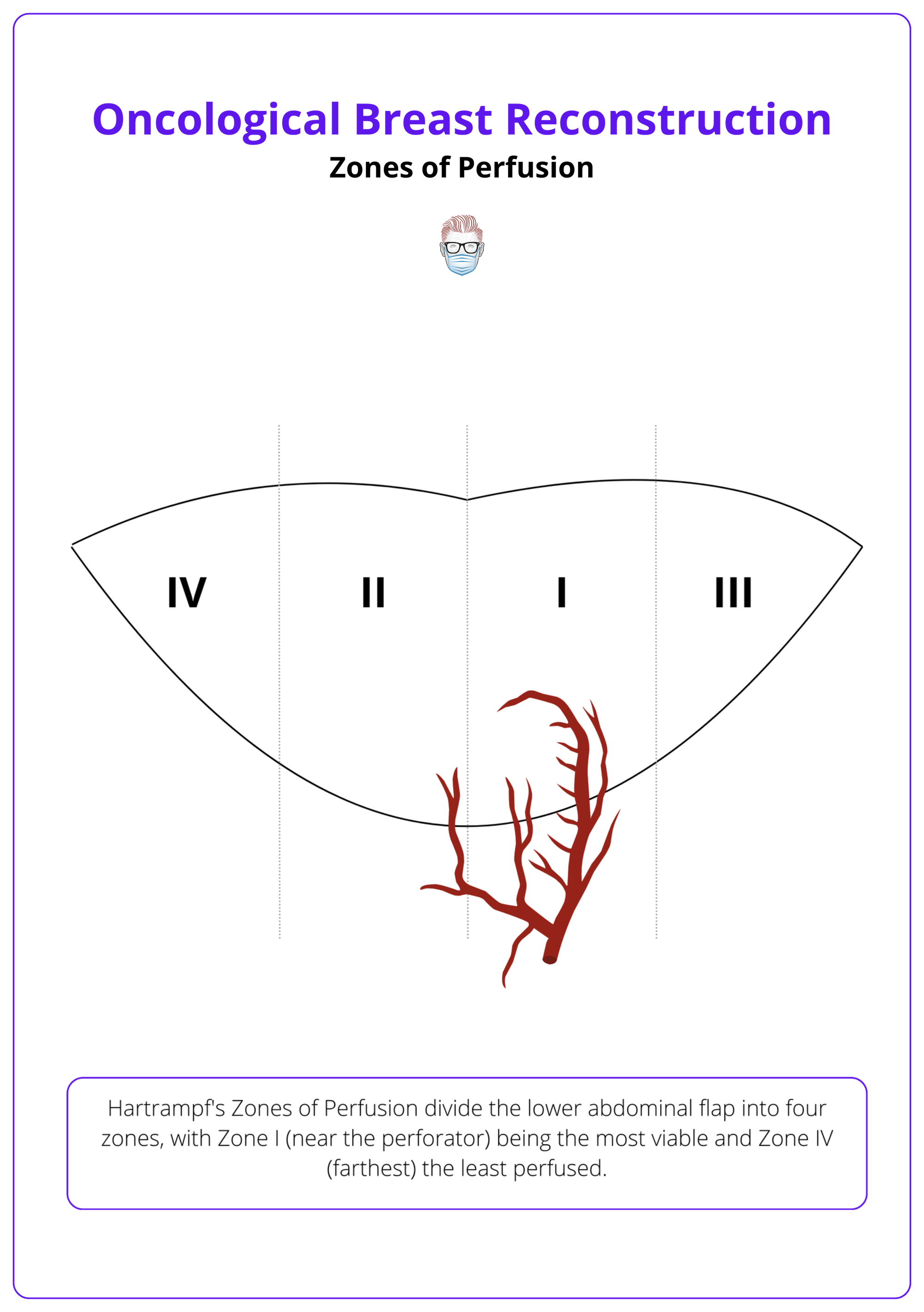 Zones of perfusion