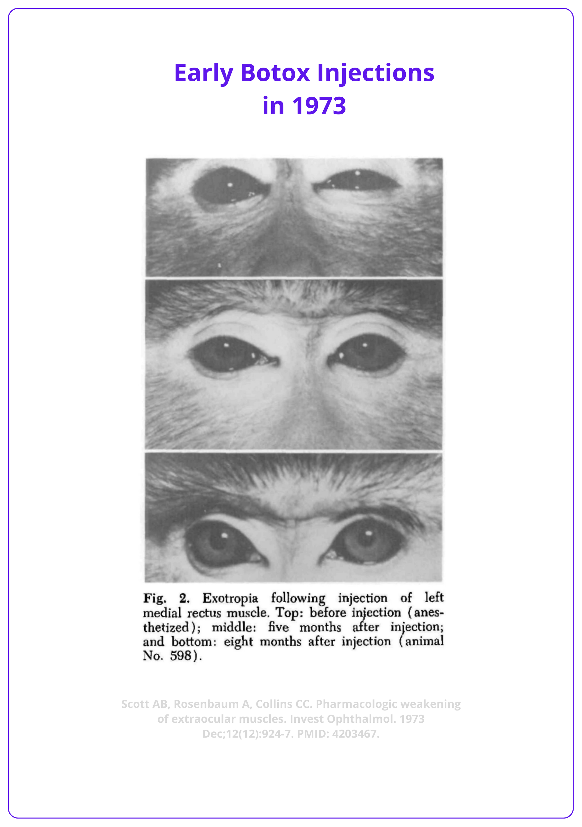 Botox on Monkeys in 1973