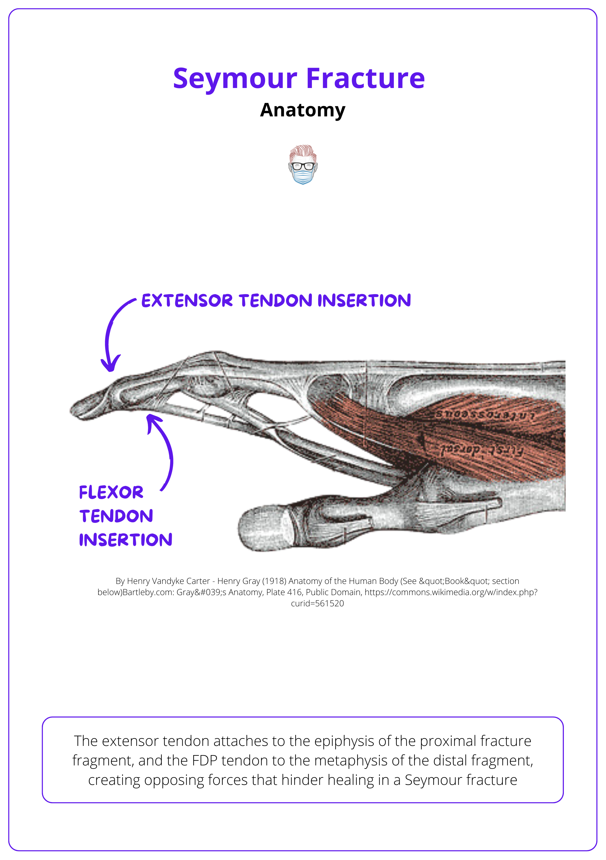 Seymour Fracture Anatomy