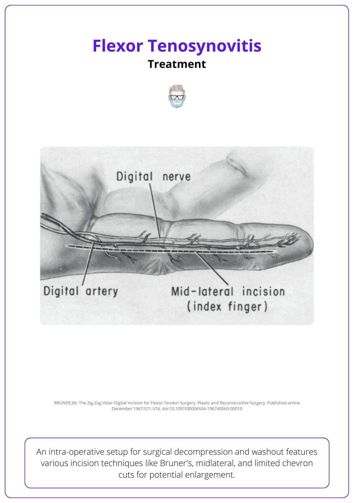 Incisions for Flexor Tenosynovitis