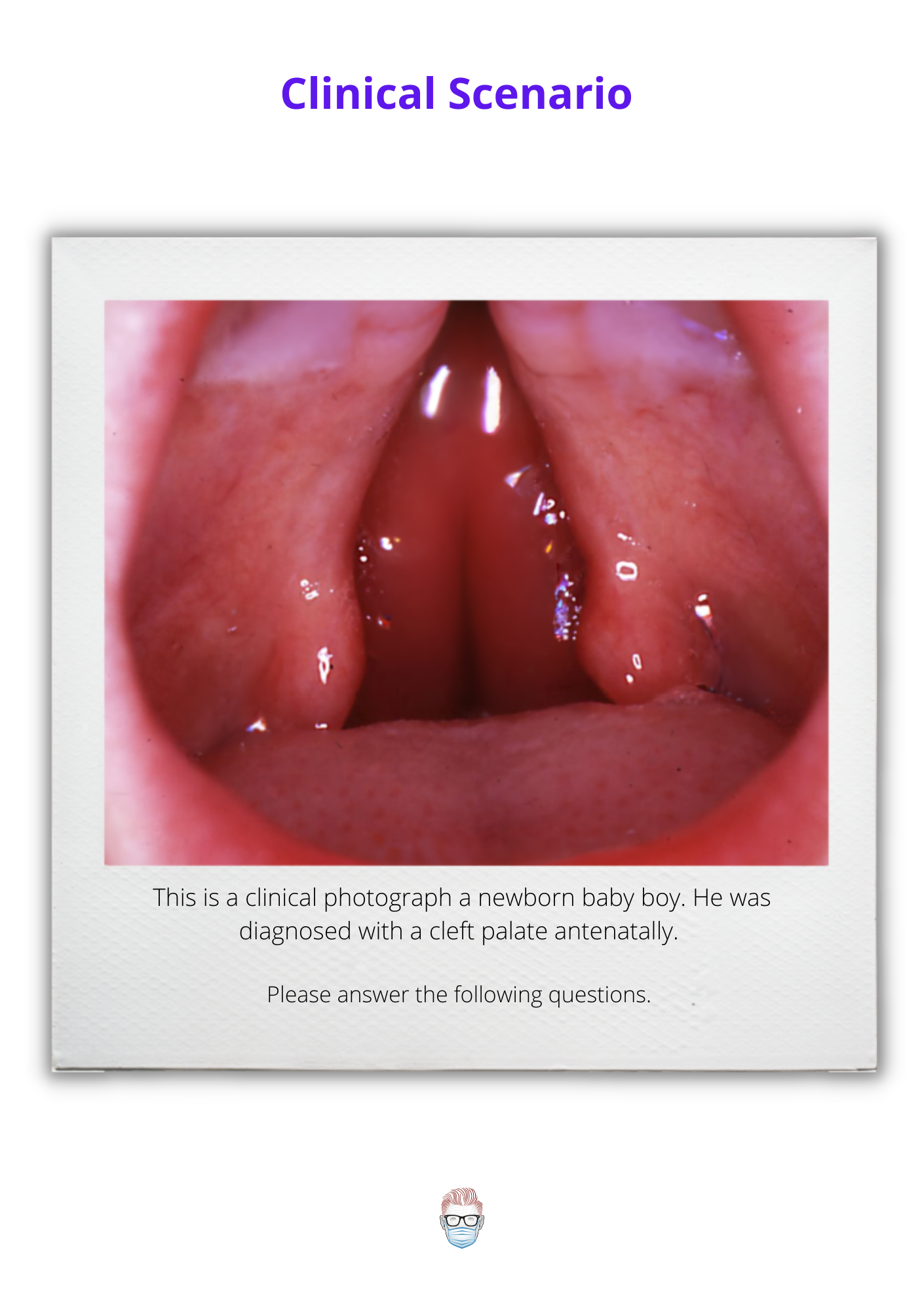 cleft-palate-clinical-case