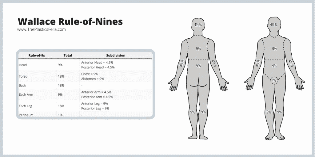 Площадь поверхности тела человека калькулятор. Rule of Nine, the. Burn area calculation. Rule of Nines Burns. Rules of Nine in Burn.