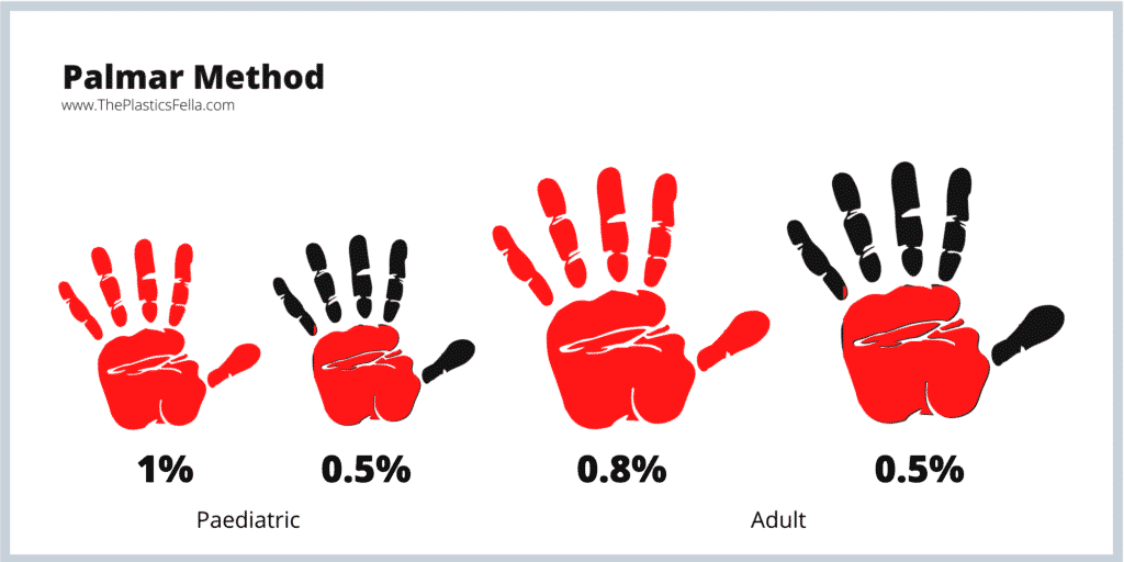 Total Body Surface Area in Burns