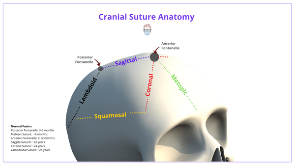 Craniosynostosis - Definition, Clinical Features, Drawings