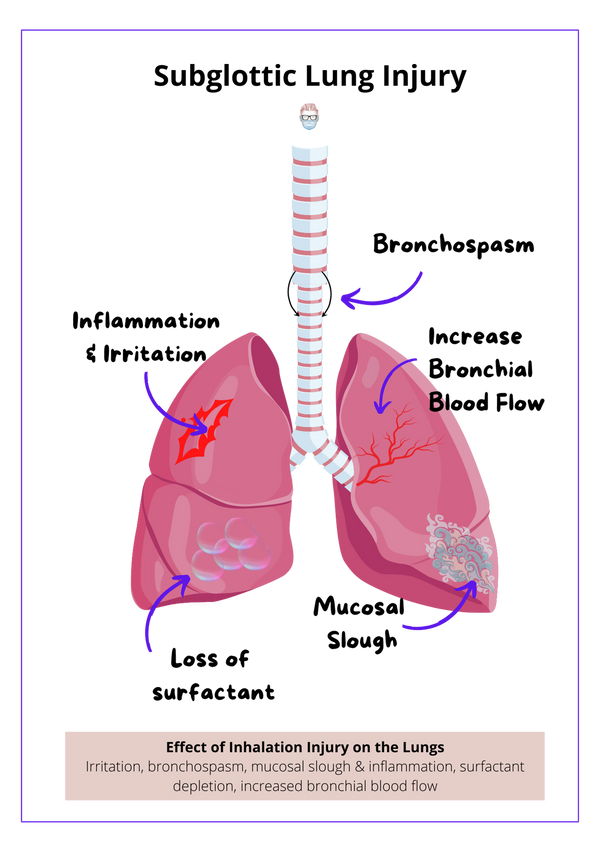 Inhalation Injury