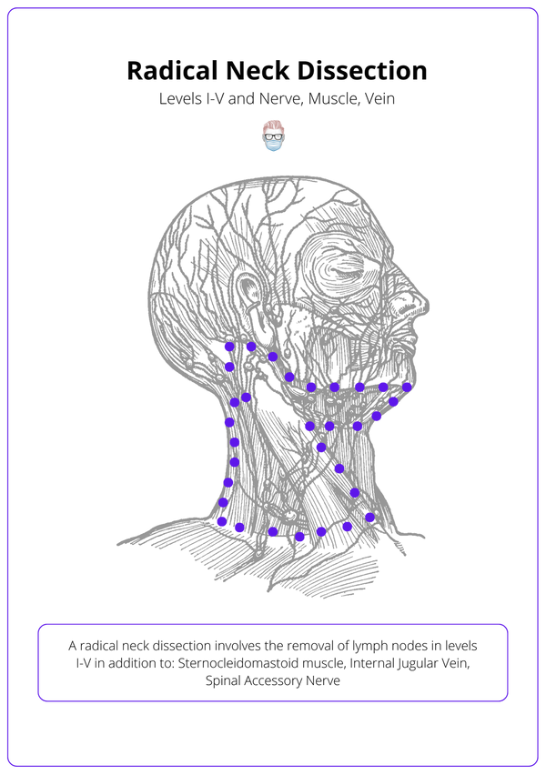 Neck Dissection · Types, Anatomy, Indications, Complications