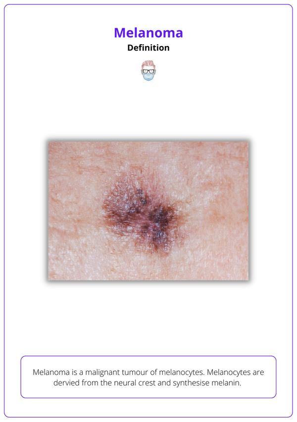 Melanoma: Diagnosis, Features, Sentinel Node, & Staging